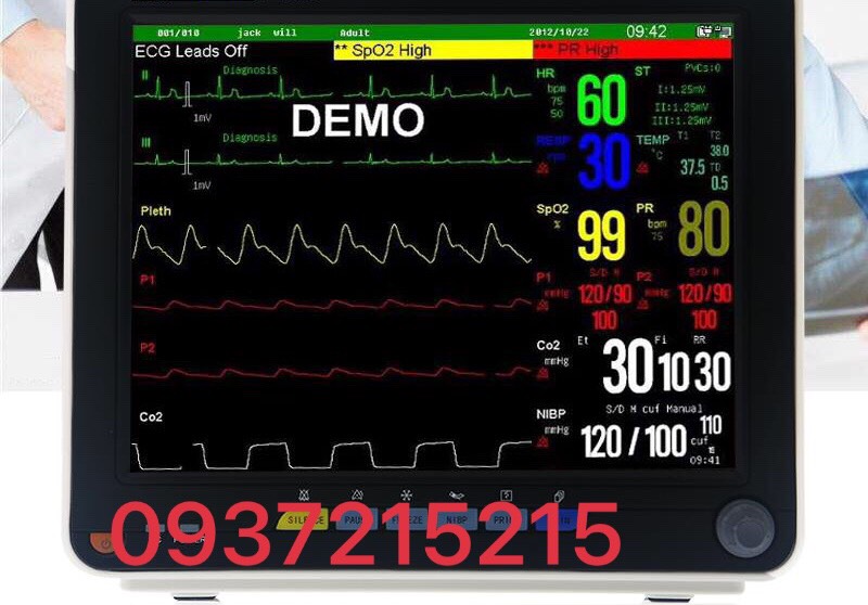Cho thuê monitor theo dõi
